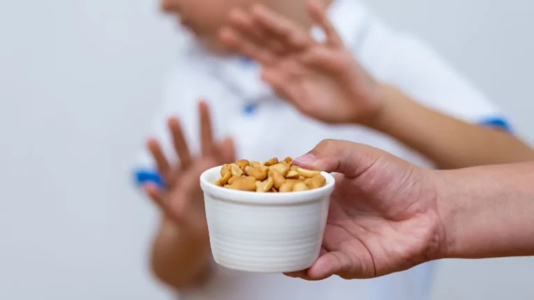 The Ultimate Guide to Understanding Nut Allergy in Kids