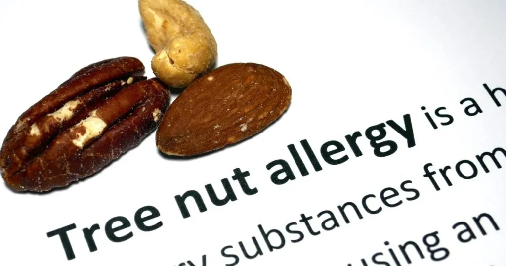 nut allergy reactions image 